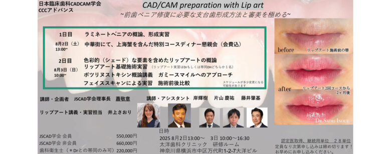 CCCアドバンス（CAD/CAM preparation with Lip art ～前歯ベニア修復に必要な支台歯形成方法と審美を極める～）開催のお知らせ