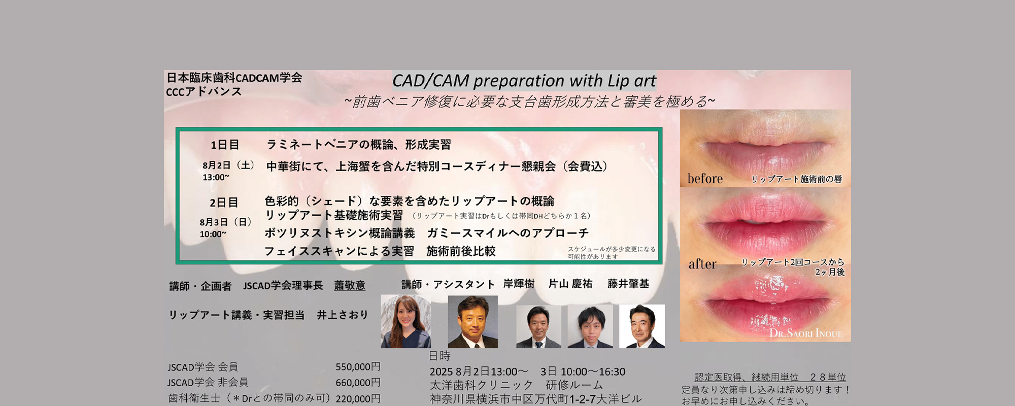 CCCアドバンス（CAD/CAM preparation with Lip art ～前歯ベニア修復に必要な支台歯形成方法と審美を極める～）開催のお知らせ